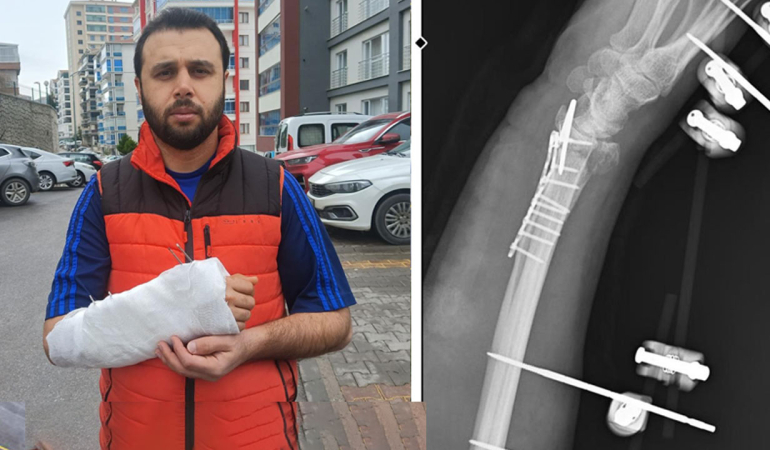 Evinin önünde dehşeti yaşadı! 10 köpekten canını zor kurtardı