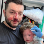 YALOVA'DA KOMŞULARIN GÜRÜLTÜ KAVGASINDA 14 AYLIK BEBEK HASTANELİK OLDU