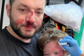 YALOVA'DA KOMŞULARIN GÜRÜLTÜ KAVGASINDA 14 AYLIK BEBEK HASTANELİK OLDU