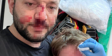 YALOVA'DA KOMŞULARIN GÜRÜLTÜ KAVGASINDA 14 AYLIK BEBEK HASTANELİK OLDU