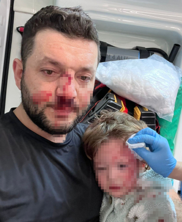 YALOVA'DA KOMŞULARIN GÜRÜLTÜ KAVGASINDA 14 AYLIK BEBEK HASTANELİK OLDU