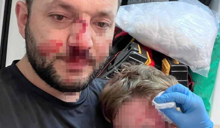 Böyle vicdansızlık görülmedi: Baba ve 14 aylık bebeğe darp