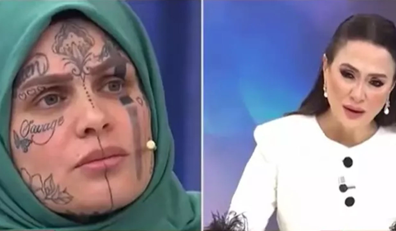 Hikayesinden çok yüzündekilerle dikkat çekti